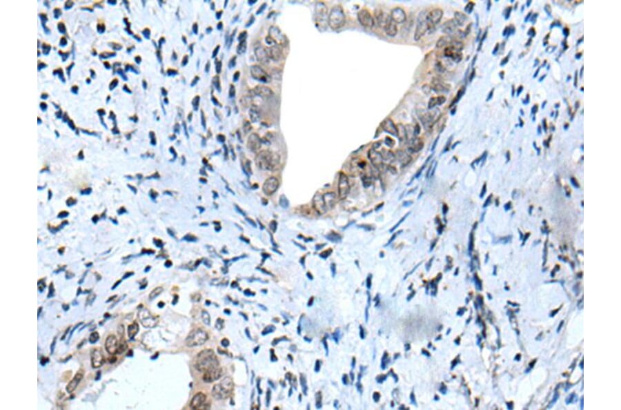 HOXD12 Antibody from Signalway Antibody (43945) - Antibodies.com