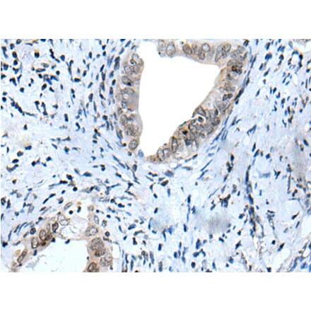 HOXD12 Antibody from Signalway Antibody (43945) - Antibodies.com