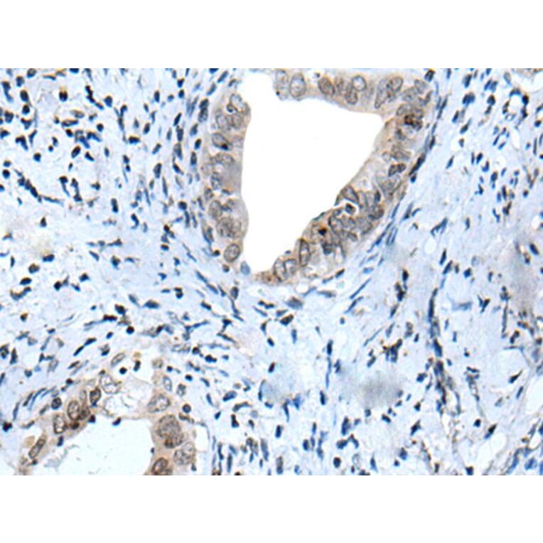 HOXD12 Antibody from Signalway Antibody (43945) - Antibodies.com