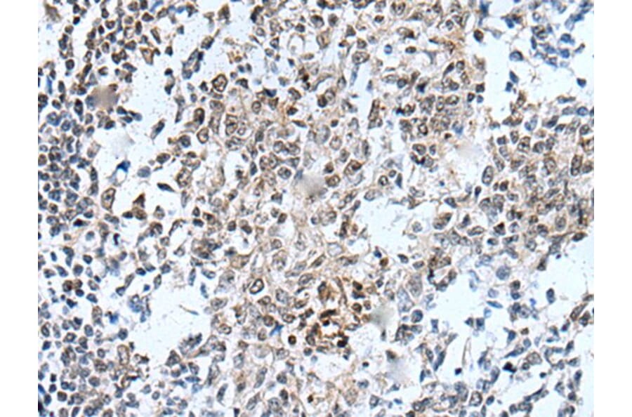HOXD12 Antibody from Signalway Antibody (43945) - Antibodies.com