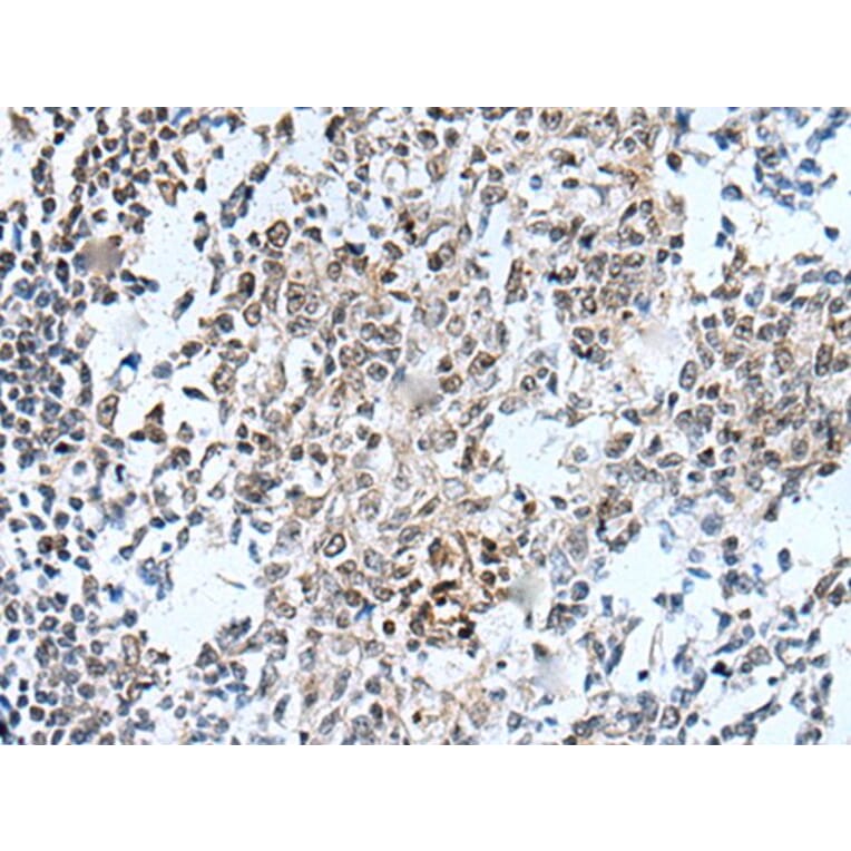 HOXD12 Antibody from Signalway Antibody (43945) - Antibodies.com