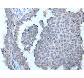 ZDHHC5 Antibody from Signalway Antibody (43969) - Antibodies.com