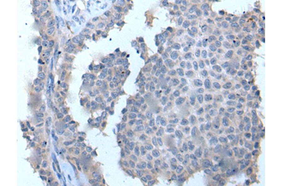 ZDHHC5 Antibody from Signalway Antibody (43969) - Antibodies.com