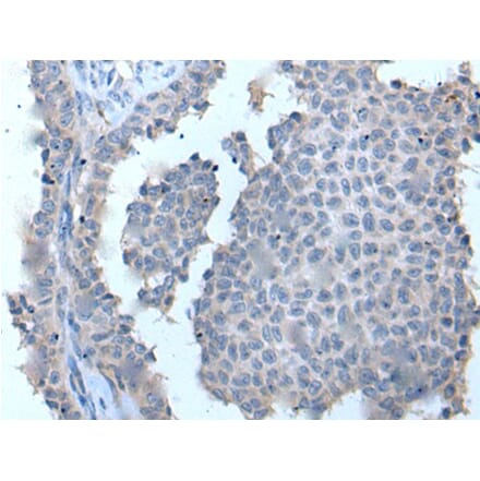 ZDHHC5 Antibody from Signalway Antibody (43969) - Antibodies.com