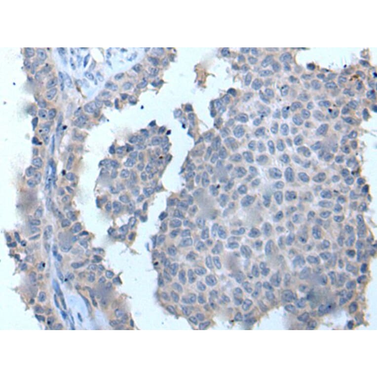 ZDHHC5 Antibody from Signalway Antibody (43969) - Antibodies.com