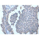 ZDHHC5 Antibody from Signalway Antibody (43969) - Antibodies.com
