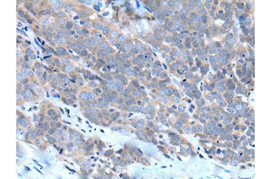 ZDHHC5 Antibody from Signalway Antibody (43969) - Antibodies.com