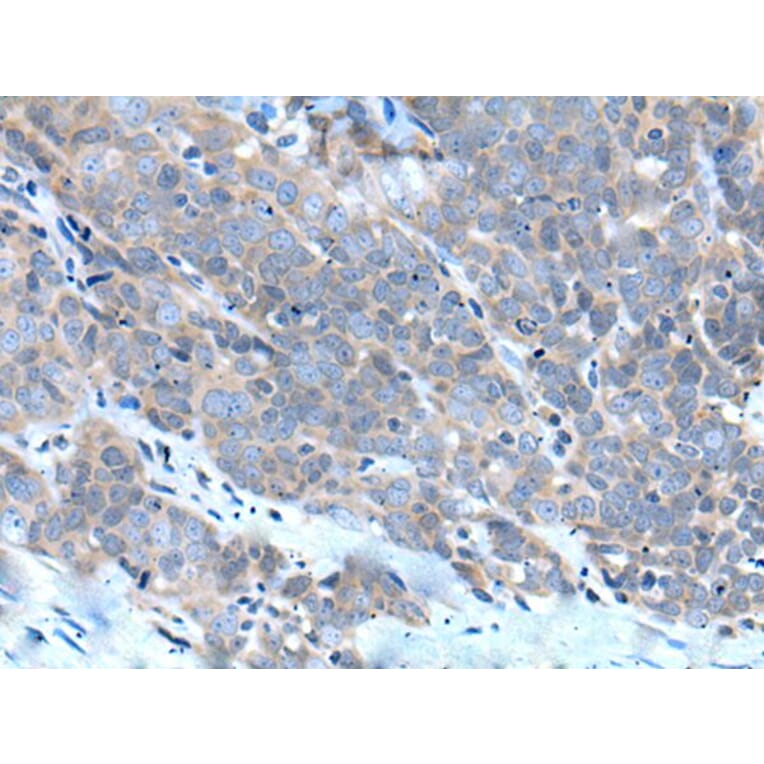 ZDHHC5 Antibody from Signalway Antibody (43969) - Antibodies.com