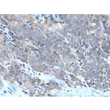 ZDHHC5 Antibody from Signalway Antibody (43969) - Antibodies.com