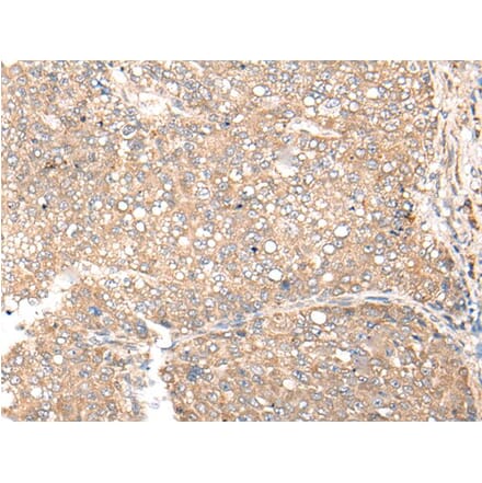 CDC123 Antibody from Signalway Antibody (43999) - Antibodies.com