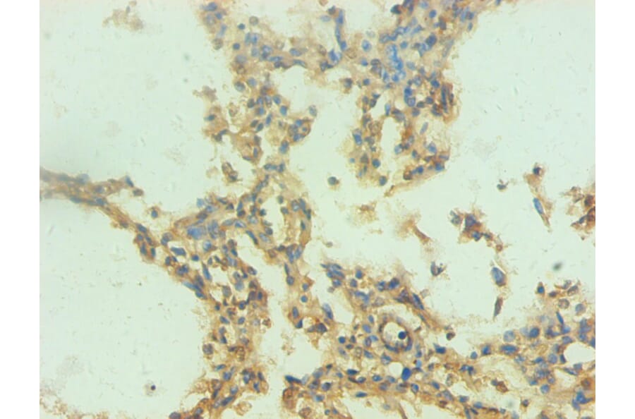 Immunohistochemistry - Protein S100-A9 Monoclonal Antibody from Signalway Antibody (42027) - Antibodies.com