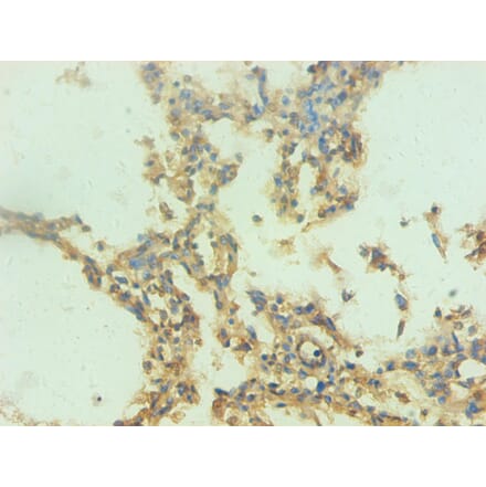 Immunohistochemistry - Protein S100-A9 Monoclonal Antibody from Signalway Antibody (42027) - Antibodies.com