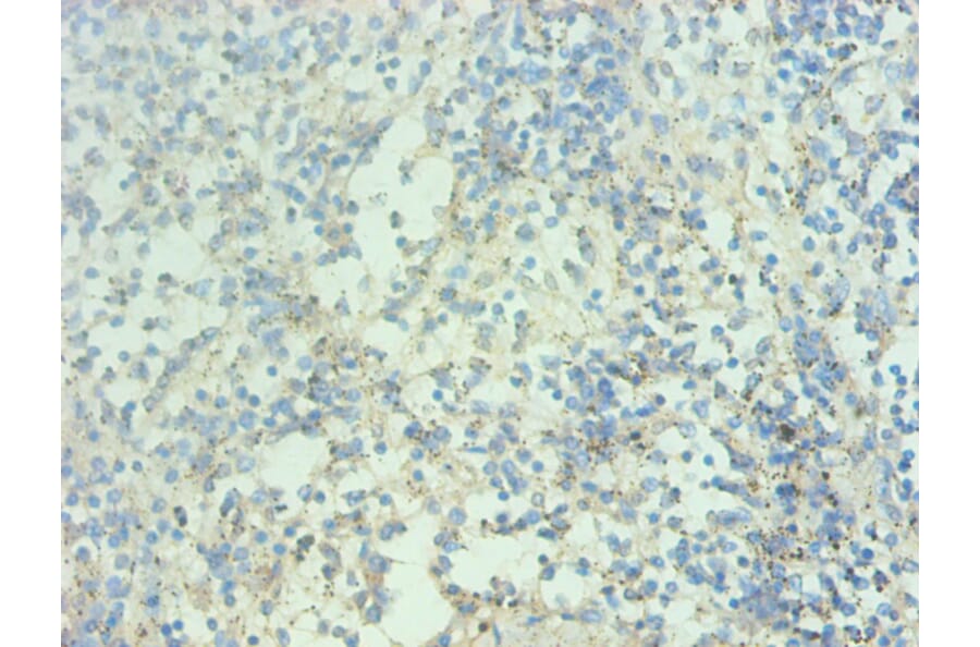 Immunohistochemistry - Protein S100-A9 Monoclonal Antibody from Signalway Antibody (42027) - Antibodies.com