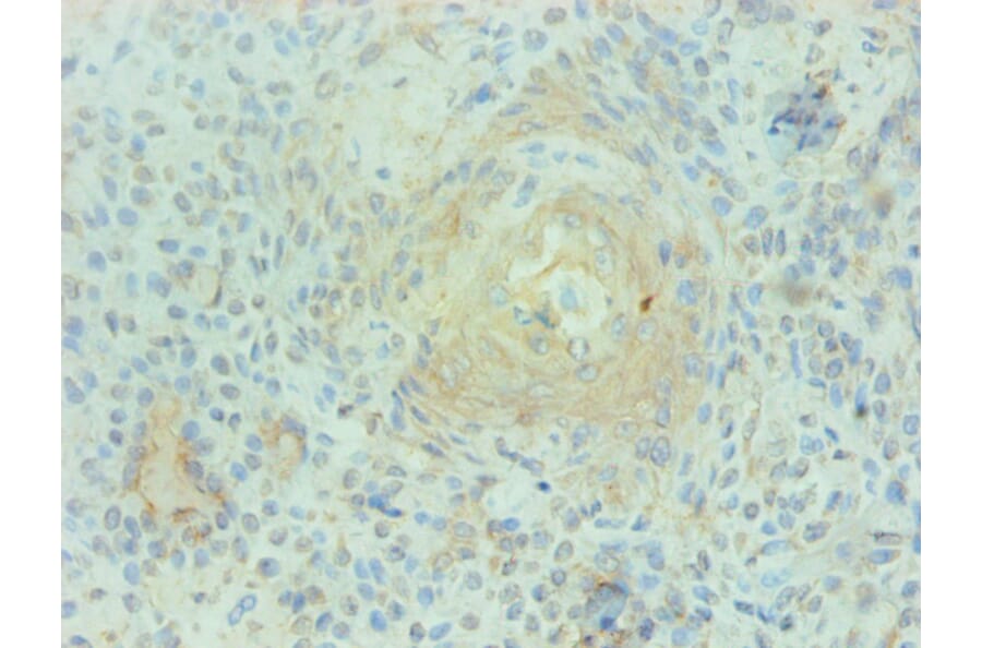 Immunohistochemistry - Protein S100-A9 Monoclonal Antibody from Signalway Antibody (42027) - Antibodies.com