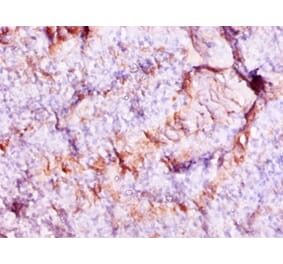 Immunohistochemistry - Protein S100-A9 Polyclonal Antibody from Signalway Antibody (42316) - Antibodies.com