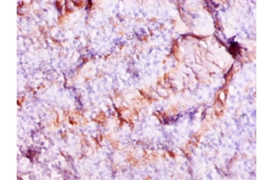 Immunohistochemistry - Protein S100-A9 Polyclonal Antibody from Signalway Antibody (42316) - Antibodies.com