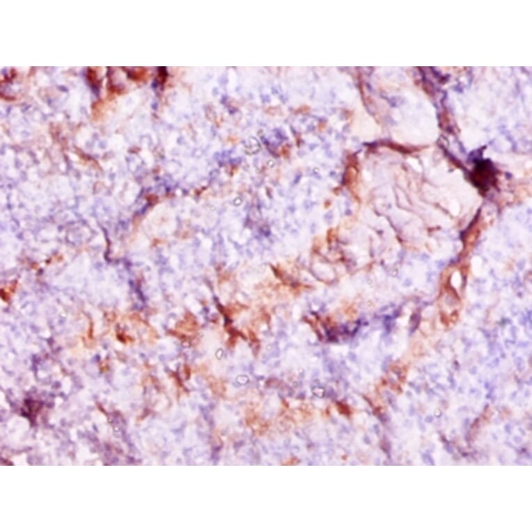 Immunohistochemistry - Protein S100-A9 Polyclonal Antibody from Signalway Antibody (42316) - Antibodies.com