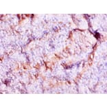 Immunohistochemistry - Protein S100-A9 Polyclonal Antibody from Signalway Antibody (42316) - Antibodies.com