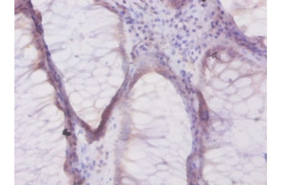 Immunohistochemistry - Beta-defensin 1 Polyclonal Antibody from Signalway Antibody (42515) - Antibodies.com