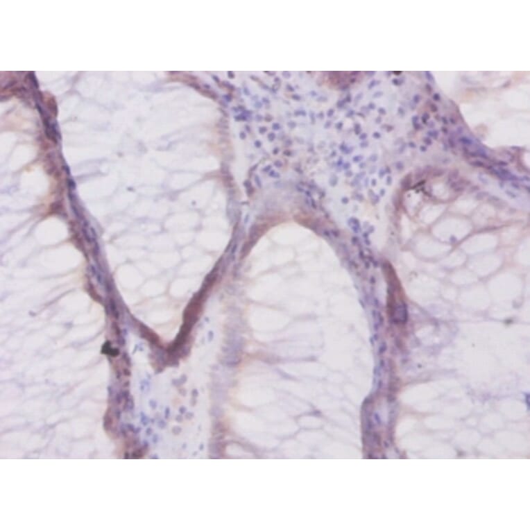 Immunohistochemistry - Beta-defensin 1 Polyclonal Antibody from Signalway Antibody (42515) - Antibodies.com