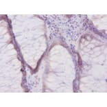 Immunohistochemistry - Beta-defensin 1 Polyclonal Antibody from Signalway Antibody (42515) - Antibodies.com