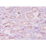 Immunohistochemistry - Beta-defensin 1 Polyclonal Antibody from Signalway Antibody (42515) - Antibodies.com