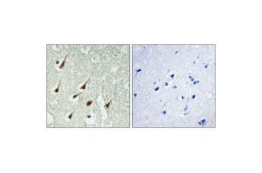 Immunohistochemistry - PKC θ Antibody from Signalway Antibody (33151) - Antibodies.com