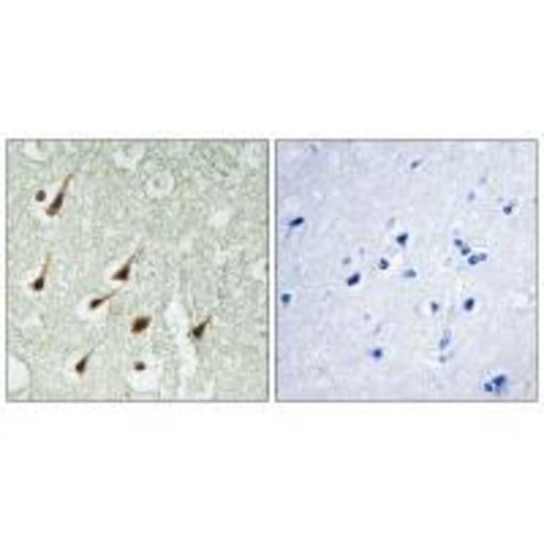 Immunohistochemistry - PKC θ Antibody from Signalway Antibody (33151) - Antibodies.com