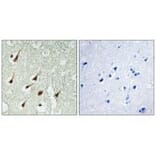 Immunohistochemistry - PKC θ Antibody from Signalway Antibody (33151) - Antibodies.com