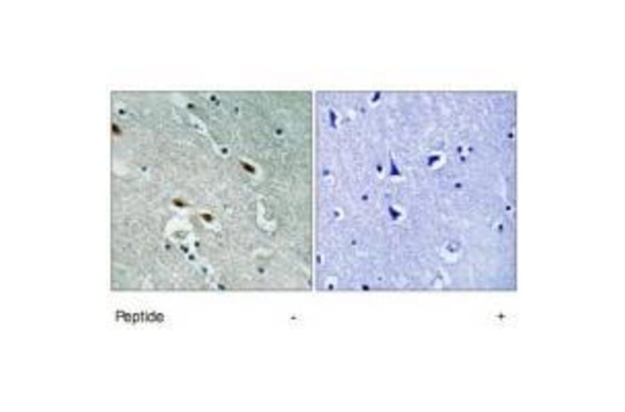 Immunohistochemistry - 53BP1 Antibody from Signalway Antibody (33297) - Antibodies.com