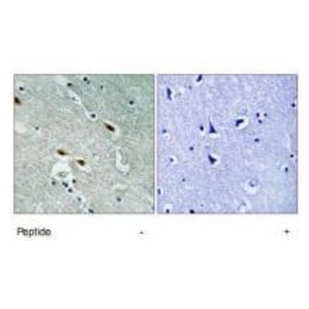 Immunohistochemistry - 53BP1 Antibody from Signalway Antibody (33297) - Antibodies.com