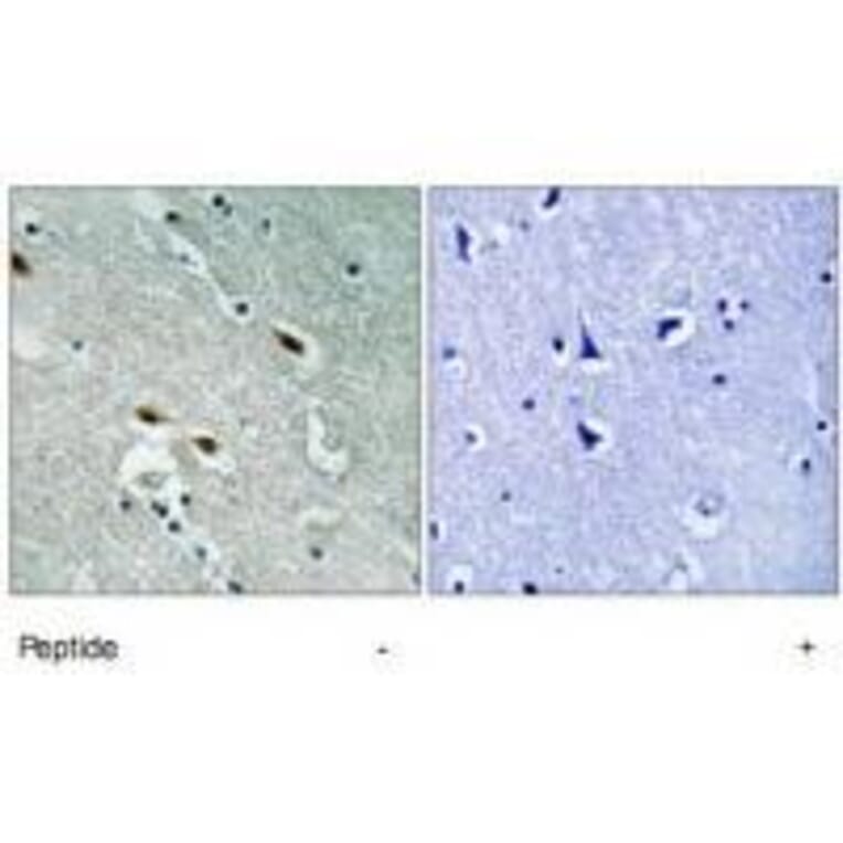 Immunohistochemistry - 53BP1 Antibody from Signalway Antibody (33297) - Antibodies.com