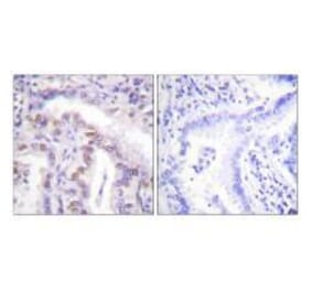 Immunohistochemistry - SENP6 Antibody from Signalway Antibody (33522) - Antibodies.com