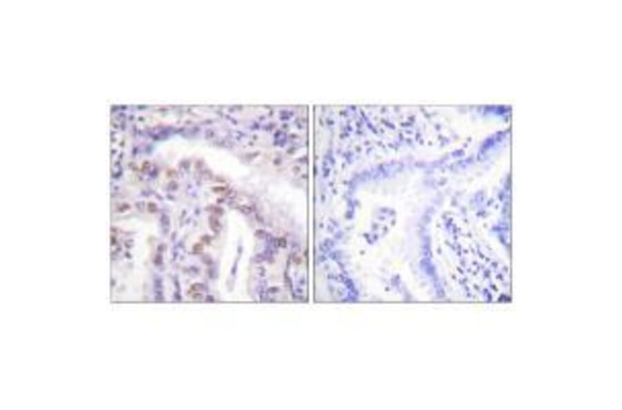 Immunohistochemistry - SENP6 Antibody from Signalway Antibody (33522) - Antibodies.com