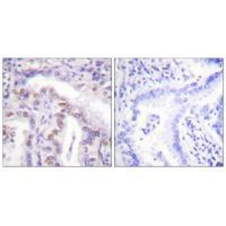 Immunohistochemistry - SENP6 Antibody from Signalway Antibody (33522) - Antibodies.com