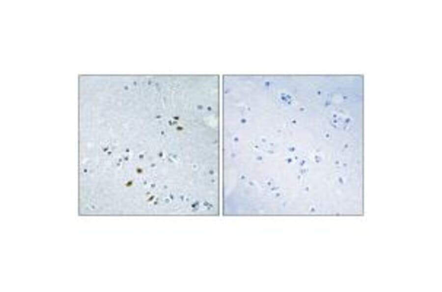 Immunohistochemistry - BRCA2 Antibody from Signalway Antibody (33796) - Antibodies.com