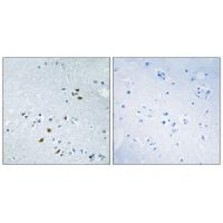 Immunohistochemistry - BRCA2 Antibody from Signalway Antibody (33796) - Antibodies.com