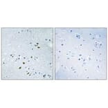Immunohistochemistry - BRCA2 Antibody from Signalway Antibody (33796) - Antibodies.com