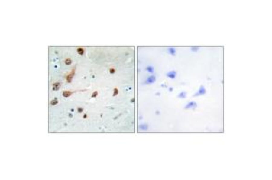 Immunohistochemistry - ADAR1 Antibody from Signalway Antibody (33822) - Antibodies.com