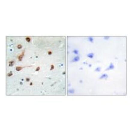 Immunohistochemistry - ADAR1 Antibody from Signalway Antibody (33822) - Antibodies.com