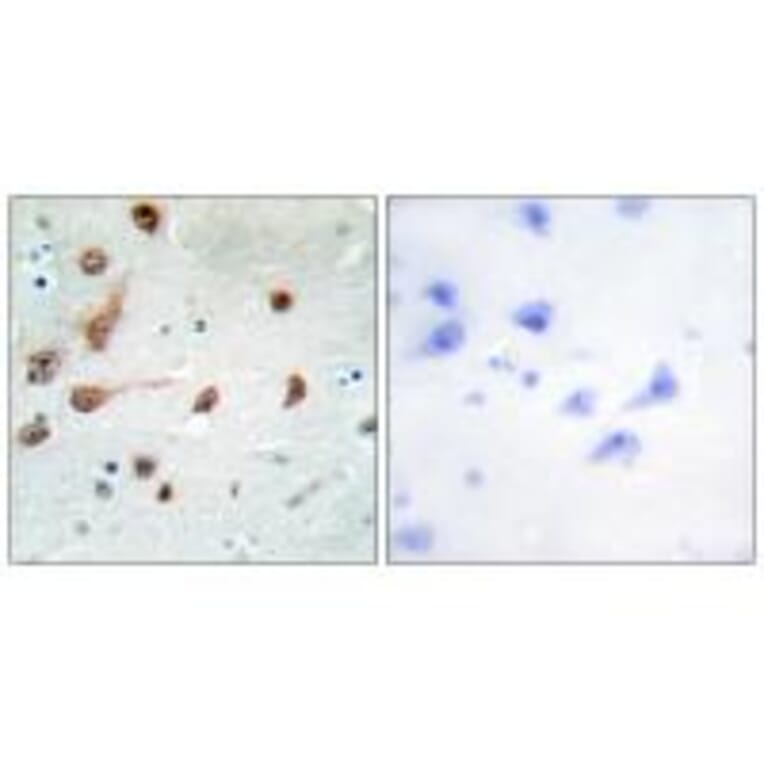 Immunohistochemistry - ADAR1 Antibody from Signalway Antibody (33822) - Antibodies.com