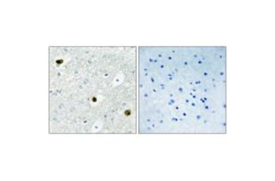 Immunohistochemistry - TPD52 Antibody from Signalway Antibody (33823) - Antibodies.com