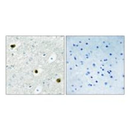 Immunohistochemistry - TPD52 Antibody from Signalway Antibody (33823) - Antibodies.com