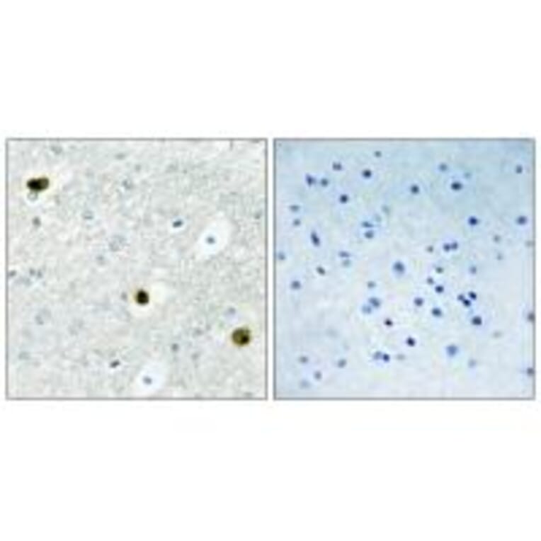 Immunohistochemistry - TPD52 Antibody from Signalway Antibody (33823) - Antibodies.com