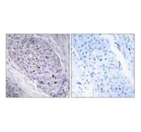Immunohistochemistry - MEF2C Antibody from Signalway Antibody (33860) - Antibodies.com