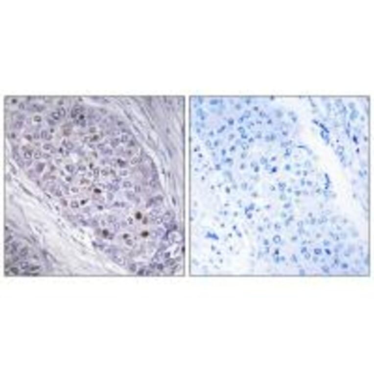 Immunohistochemistry - MEF2C Antibody from Signalway Antibody (33860) - Antibodies.com