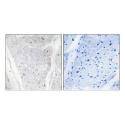 Immunohistochemistry - ALPK2 Antibody from Signalway Antibody (33951) - Antibodies.com