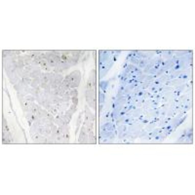 Immunohistochemistry - ALPK2 Antibody from Signalway Antibody (33951) - Antibodies.com