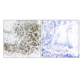 Immunohistochemistry - TRPS1 Antibody from Signalway Antibody (34103) - Antibodies.com