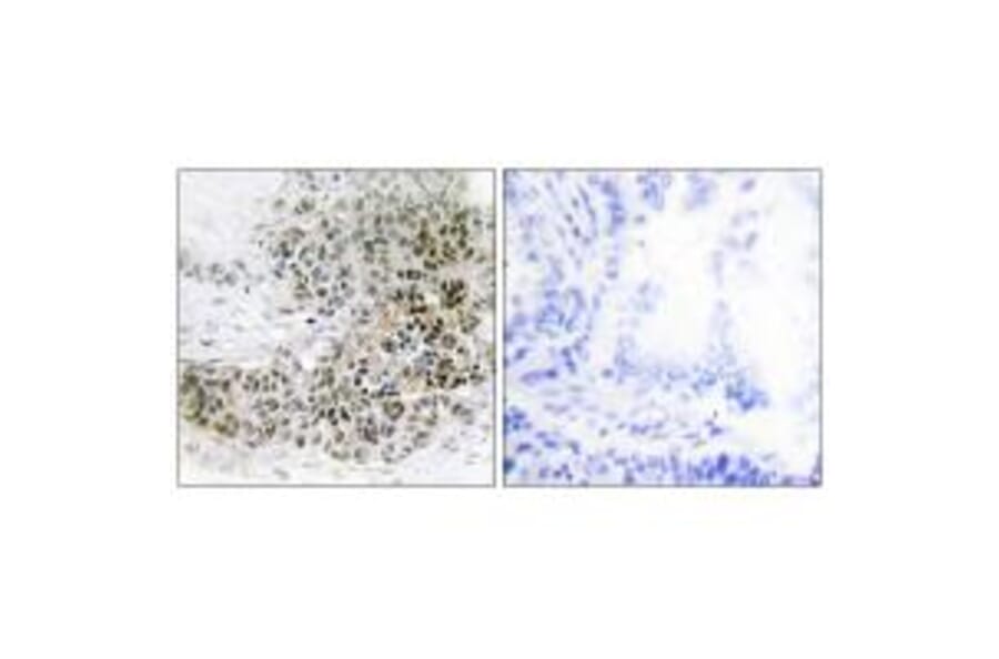 Immunohistochemistry - TRPS1 Antibody from Signalway Antibody (34103) - Antibodies.com